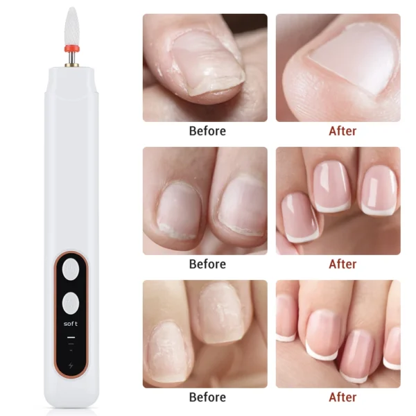 6-in-1 Cordless Electric Nail File Set - Image 6